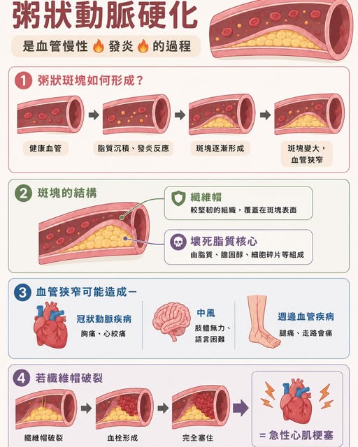 血管內賊 2 號:血脂報告,最重要的是 LDL