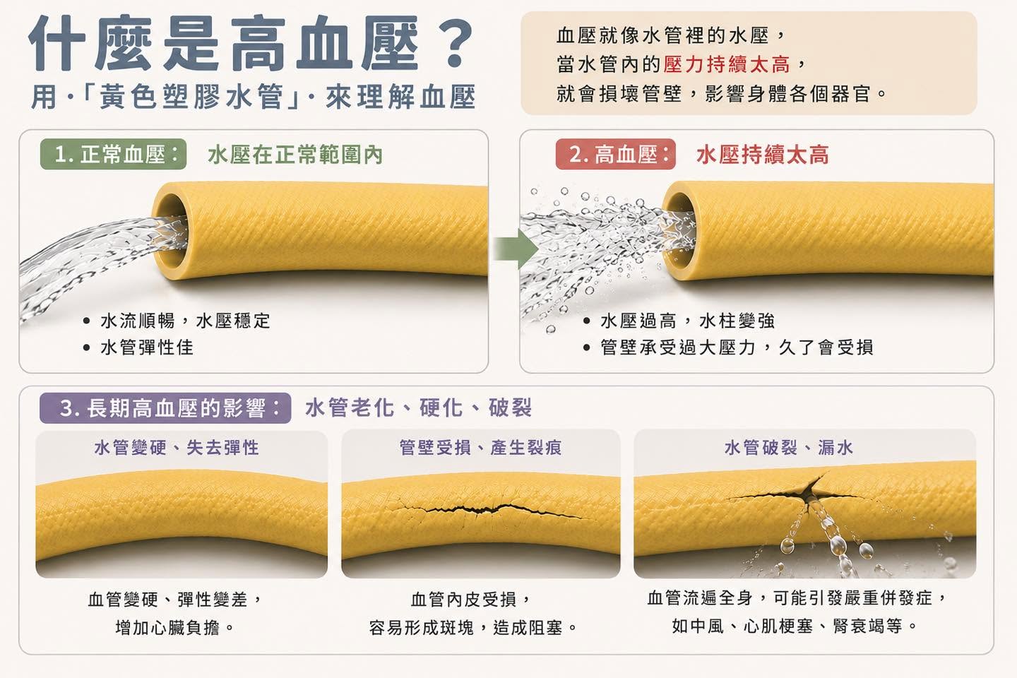 【血管內賊3號 - 高血壓！】